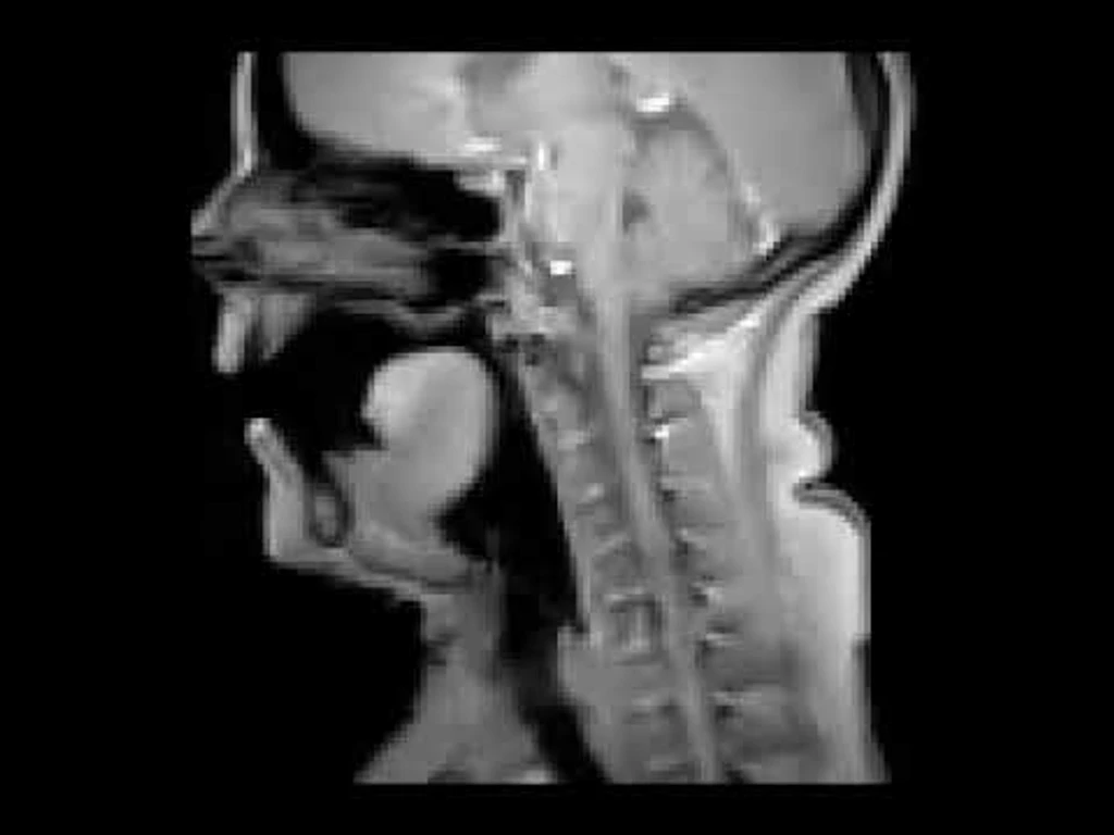 - Figure 1 - 