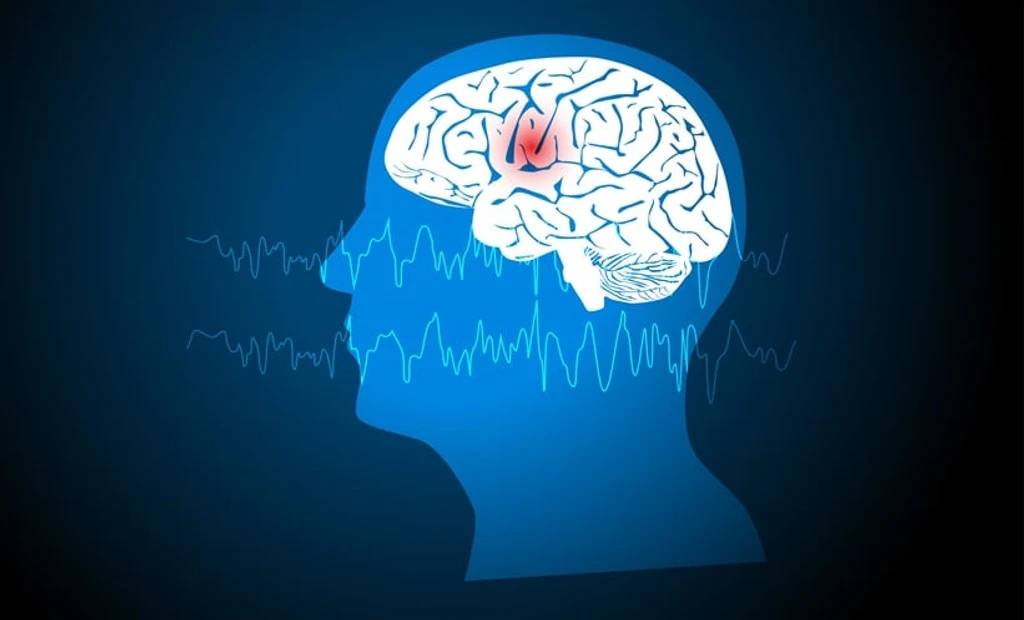 Zorevunersen Shows Promise in Treating Dravet Syndrome Seizures